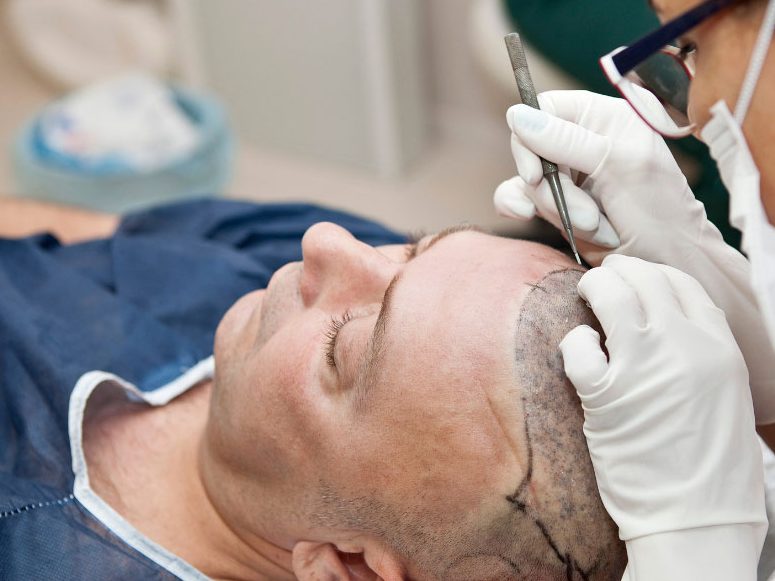 Established Medical Aesthetics Clinic – CQC Registered – Central Manchester